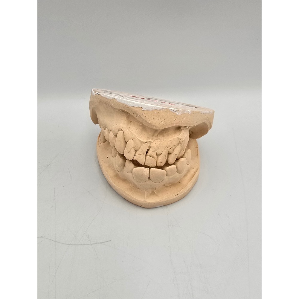 Henry Schein Dental Mold Teeth Plaster Model Tan Good Medical Oddity‎ Oddities